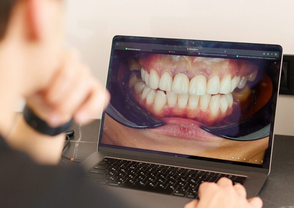 treatment of tooth decay
